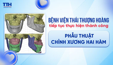 BỆNH VIỆN THÁI THƯỢNG HOÀNG TIẾP TỤC THỰC HIỆN THÀNH CÔNG PHẪU THUẬT CHỈNH XƯƠNG HAI HÀM 